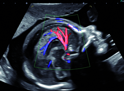 hoppe home neurosonografie 1
